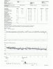 Sleep study results May 2016 No name Low oxygen, back on machine.jpg