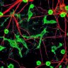 Potential Microglia Inhibitors