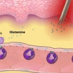 The Inflammatory Response [HD Animation] - YouTube