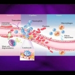 04 Human Body. The Inflammatory Response - YouTube