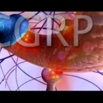 A Day in the Life of a Neurologist and Migraine Sufferer - YouTube