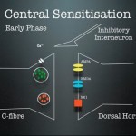 Peripheral and central sensitisation - YouTube