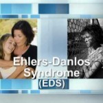 What Is Ehlers-Danlos Syndrome? - YouTube
