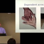 CSF presents "Dysautonomia & Postural Orthostatic Tachycardia in the Chiari/EDS Population" - YouTube