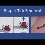 Lyme Disease -- History and Current Controversies - YouTube