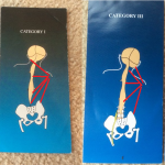 Cranio-Sacral forces