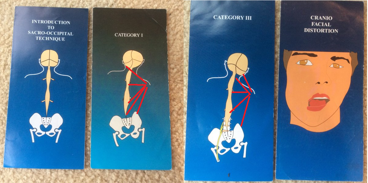 Cranio-Sacral forces