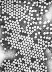 The antibodies found in SPS are associated with enterovirus infections.