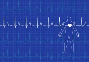 EKG Chart