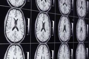 brain-scans