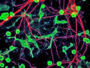 microglia