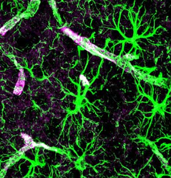Astrocytes