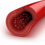 Nimodipine may be able to increase cerebral blood vessel flow - a key problem for some ME/CFS and POTS patients