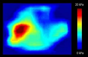 trigger-point-heat-image