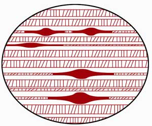 trigger-point fibers