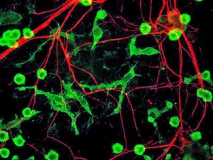Several German researchers believe PEA may be up to upregulate microglia killing ability without causing inflammation