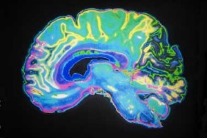 MRI