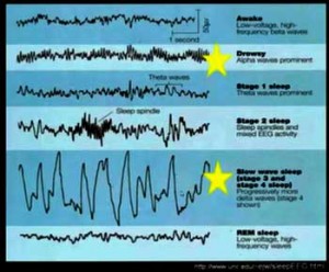 sleep-study