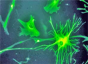 astrocyte