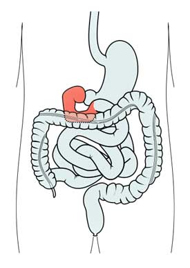 duodenum