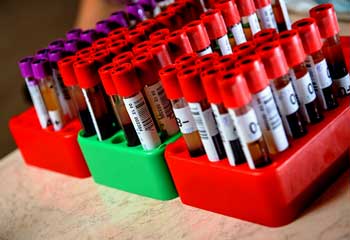 test-tubes-blood