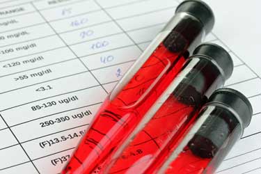 Fibromyalgia Blood Test Going Mainstream?