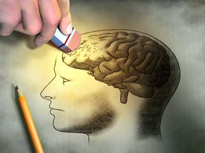 reduce brain activation chronic fatigue syndrome