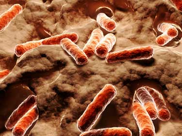 Exercise prompted the growth of gut bacteria in people with ME/CFS