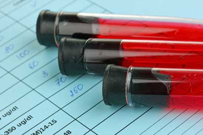 Can Simple Blood Tests Help to Identify Chronic Fatigue Syndrome (ME/CFS)?
