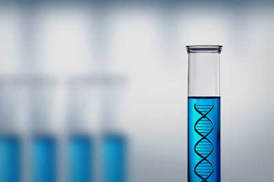 The increased expressioni of an interferon associated gene has shown up in both ME/CFS and hepatitis C patients given IFN-B