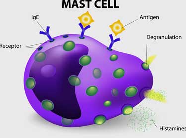 Are You ‘Activated’? Mast Cell Activation Syndrome and ME/CFS/FM