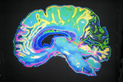 coloured-mri-scanbrain