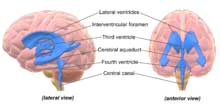 ventricles- brain- lactate-ME-CFS