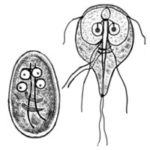 giardia chronic fatigue syndrome