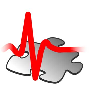 heart rate ME/CFS