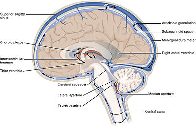 Pressure Mounting: Is Fibromyalgia Caused By High Pressure in the Brain (Intracranial Hypertension)