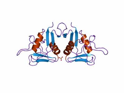 Large NK Cell Study Points to Autoimmunity and Inflammation in Chronic Fatigue Syndrome (ME/CFS)