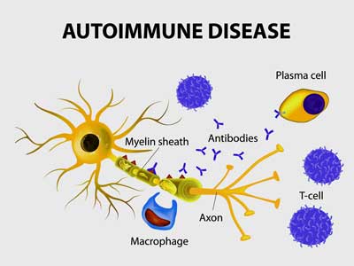 autoimmunity POT