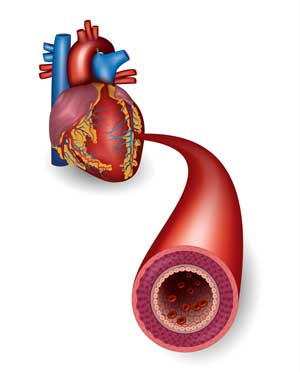 deconditioning ME/CFS