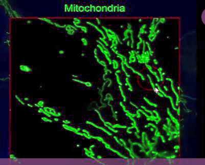 Prusty mitochondria shape