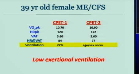 ventilation ME/CFS