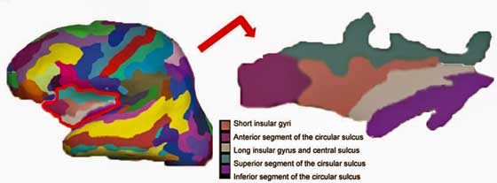 insula-fibromyalgia