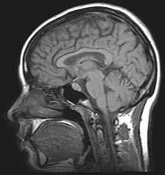Over 200 brain MRI's were done