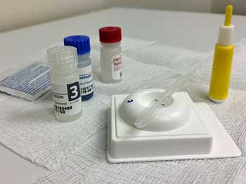Antibody testing for coronavirus