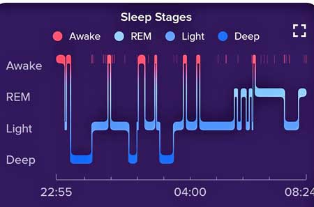 A characteristic sleep stage pattern showing more deep or NREM sleep earlier in the night and more REM seep later in the morning