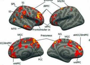 neuroinflammation GWI