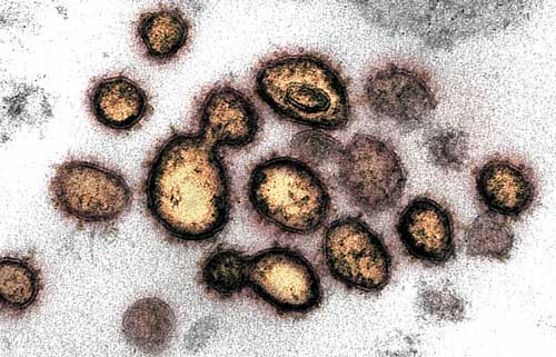 The coronavirus - danger and opportunity