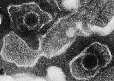 Old Drug Points To New Way To Knock the Epstein-Barr Virus Down