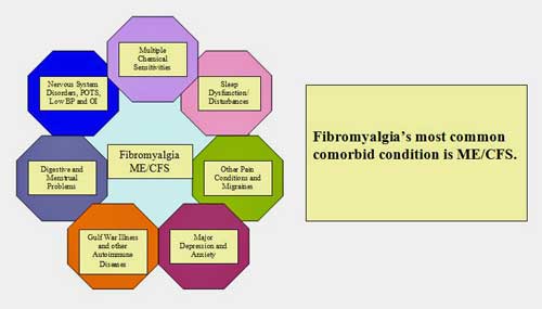 fibromyalgia POTS