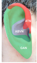 non-invasive VNS